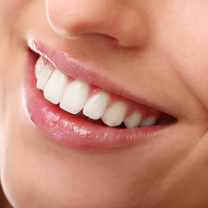 sonrisa-perfecta-dientes-blancos-primer-plano